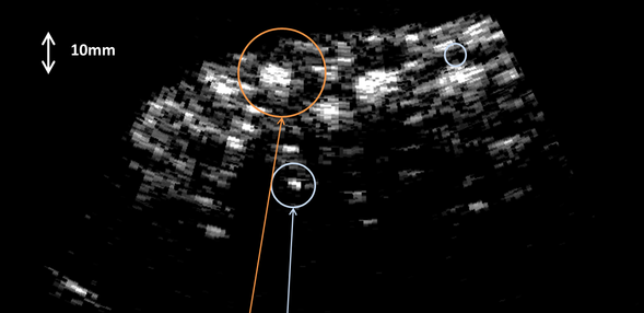 Murgen: Open Source ultrasound imaging